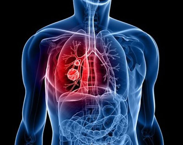 Akciğerlerdeki parazitler