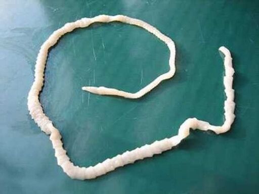 insan domuz tenyası