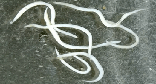 insan vücudundaki kıl kurtları