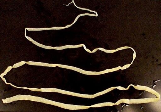 insan vücudundan geniş tenya