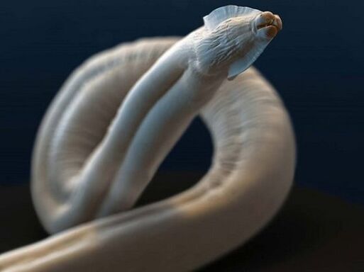 insan vücudundan toksokara