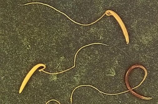 insan vücudundan çıkan kamçı kurdu