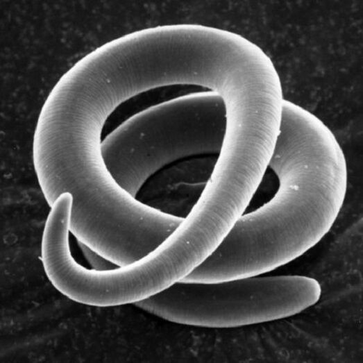 insanlarda solucan paraziti trichinella