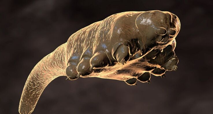 deri altı parazit demodex akarı