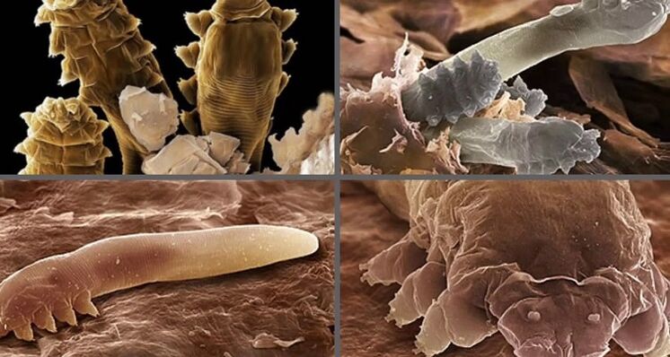 insan kutanöz parazit türleri